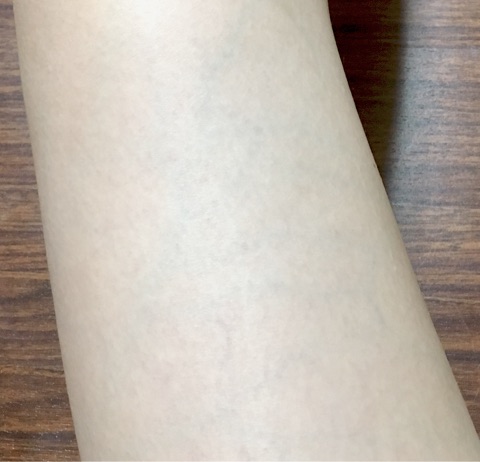 口コミ：光と超音波で肌に優しい！光脱毛ｴﾋﾟﾚﾀﾌﾟﾛ【モニター参加中】の画像（7枚目）