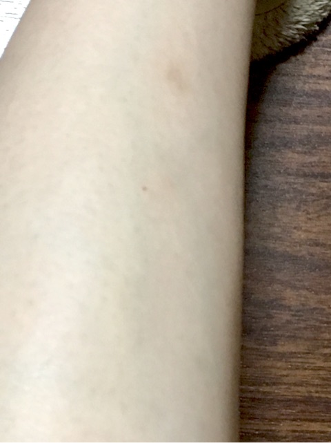 口コミ：光と超音波で肌に優しい！光脱毛ｴﾋﾟﾚﾀﾌﾟﾛ【モニター参加中】の画像（8枚目）