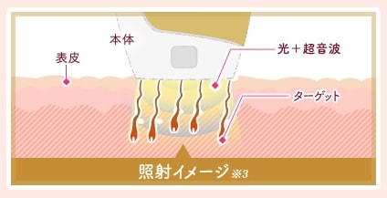 口コミ：家庭用光脱毛器エピレタプロは効果があるのか？実際に使ってみました♪の画像（2枚目）