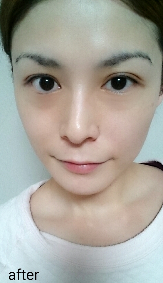 口コミ：SIMIUS WHITENING LIFT-CARE GEL ☆話題のシミウス☆の画像（12枚目）