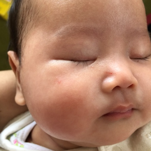 口コミ：生後2ヶ月　乳児湿疹に悩む( ;∀;)　赤ちゃんの肌を守る「アトピコ」の画像（9枚目）