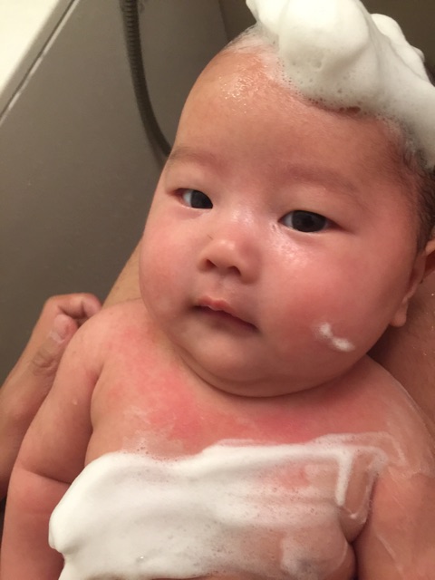口コミ：生後2ヶ月　乳児湿疹に悩む( ;∀;)　赤ちゃんの肌を守る「アトピコ」の画像（11枚目）