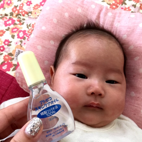 口コミ：生後2ヶ月　乳児湿疹に悩む( ;∀;)　赤ちゃんの肌を守る「アトピコ」の画像（7枚目）