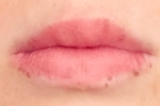 「唇のシミ…」の画像