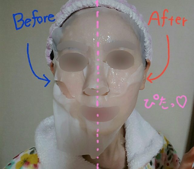 口コミ：毛穴スキンケアケアブランドのシートマスクを使用した結果…の画像（4枚目）