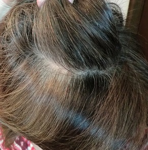 口コミ：ルプルプ　ヘアカラーフォームの画像（6枚目）