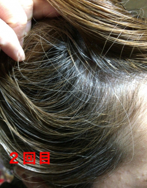 口コミ：ＬＰＬＰヘアカラーフォーム（白髪用）液だれ無し！の画像（10枚目）