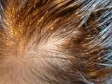 口コミ：美髪の秘訣は頭皮から!! 椿油で浮かせて、洗う『頭皮のオイル＆頭皮を洗うシャンプー｝の画像（3枚目）