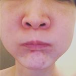 夏までに顔痩せしたひ…(cのInstagram画像