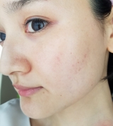 口コミ：米ぬかエキスで夏の紫外線から肌を守る【米肌】｜chisaの美容奮闘記 ～chisa official blog～の画像（1枚目）
