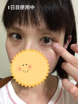 口コミ：すこやか素肌　尿素のしっとり目もとクリームの画像（9枚目）