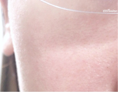 口コミ：
  １ヶ月使用レポ 赤ら肌改善  『  ULU シェイクモイストミ  』ルク
の画像（3枚目）