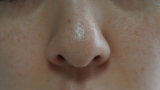 口コミ：洗顔せっけんドットウォッシーでいちご鼻改善作戦！❤️③❤️の画像（2枚目）
