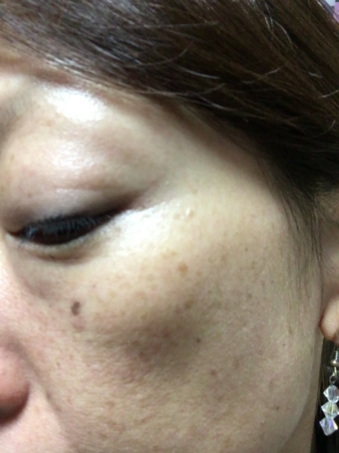口コミ：乾燥肌にも極上の潤いアルピニエッセンスの画像（6枚目）