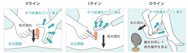 口コミ：トゥルリーヌ セルフ脱毛ワックス トゥルリーヌの画像（5枚目）