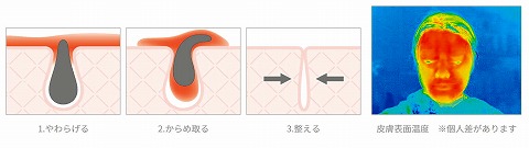 口コミ：毛穴ケアにいいね♪リファホットクレンズ CLの画像（8枚目）