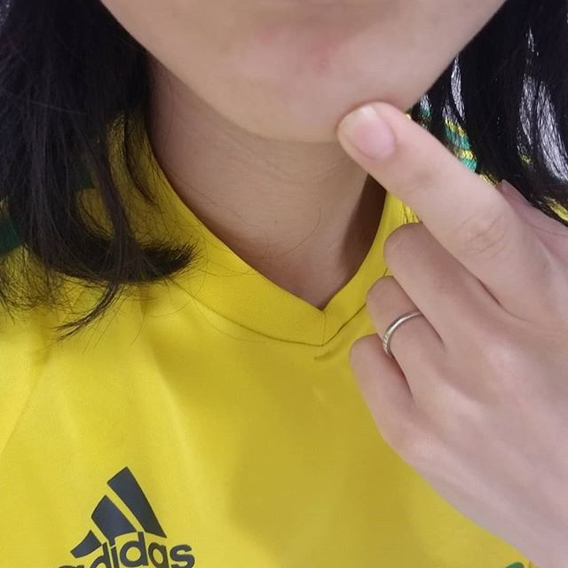 口コミ投稿：コンシーラーはじめて使ってみました🔰ちょうど揚げ物つくったらあごにニキビができて…