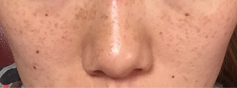 ビタブリッドcフェイス ブライトニング Mokoさんのクチコミ 口コミ レビュー記事 世界特許取得の ビタブリッドc ファンページ ビタブリッドジャパン