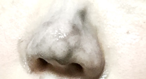 口コミ：小鼻の黒ずみに♡JUSO KURO PACKの画像（7枚目）