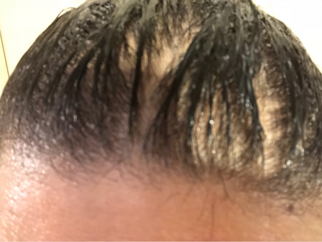 口コミ：髪質改善研究所 ボタニカルヘッドスパの画像（4枚目）