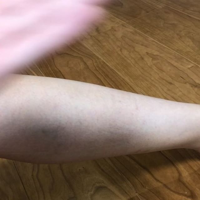 口コミ投稿：KJ美脚ジェル３日目(o^^o)今回は動画で❗️汚い脚ですみません。。 少量で伸びが良くて…