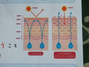 口コミ：お肌が弱い！超敏感肌さん！肌バリアを強化するセラミドスキンケアの画像（6枚目）