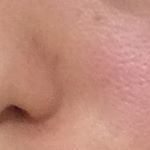 現在の私の肌のアップ画像😰毛穴ヤバすぎる…どうにかしたい#ライスフォース #riceforce #monipla #riceforceacpoless_fanのInstagram画像