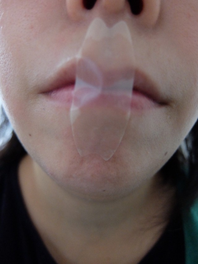 口コミ：鼻呼吸でいびき防止テープの画像（6枚目）