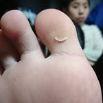 空手で踏ん張って皮がむけたらしく、そこに使ってみました。普通の絆創膏みたいだけど、貼ってみるとフィルム。貼って押さえたらバッチリ。水もはじいて洗っても平気。極薄透明だから、動かす場所に…のInstagram画像