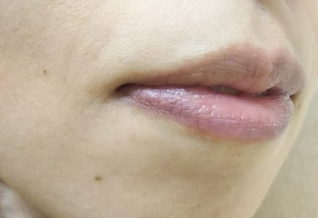 口コミ：シャルレ エタリテ リップエッセンス 唇のための美容液 使った感想 やさしいリップクリームでケアの画像（8枚目）