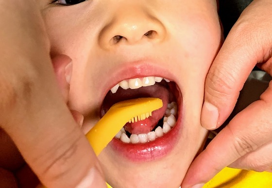 口コミ：お子様にも舌磨き習慣を🎵ののじ子ども舌クリーナー「舌も！Kids」の画像（4枚目）