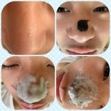 口コミ：頑固ないちご鼻に炭酸泡パック！『JUSO KURO PACK』の画像（3枚目）