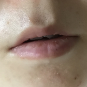 「乾燥している唇」SASS.シュガースクラバーム　モニター 5名募集！の投稿画像