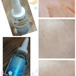 huimeitianbian長期モニター『年齢に負けない肌を作る　EGF美容液』（2回目）になります。朝、晩の洗顔後にTBC EGF エクストラエッセンスを約1ヶ月間使用した肌の変化をレポート…のInstagram画像