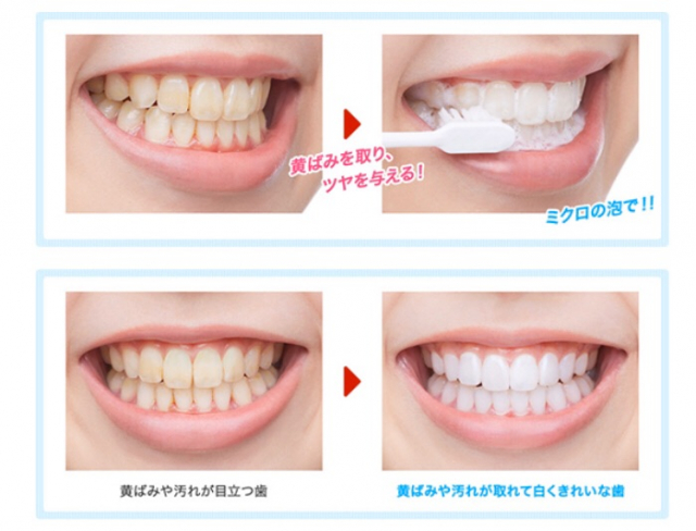 口コミ：【歯が白くなる？！】ホワイニングできる歯磨き粉使ったみたー！^ ^の画像（4枚目）