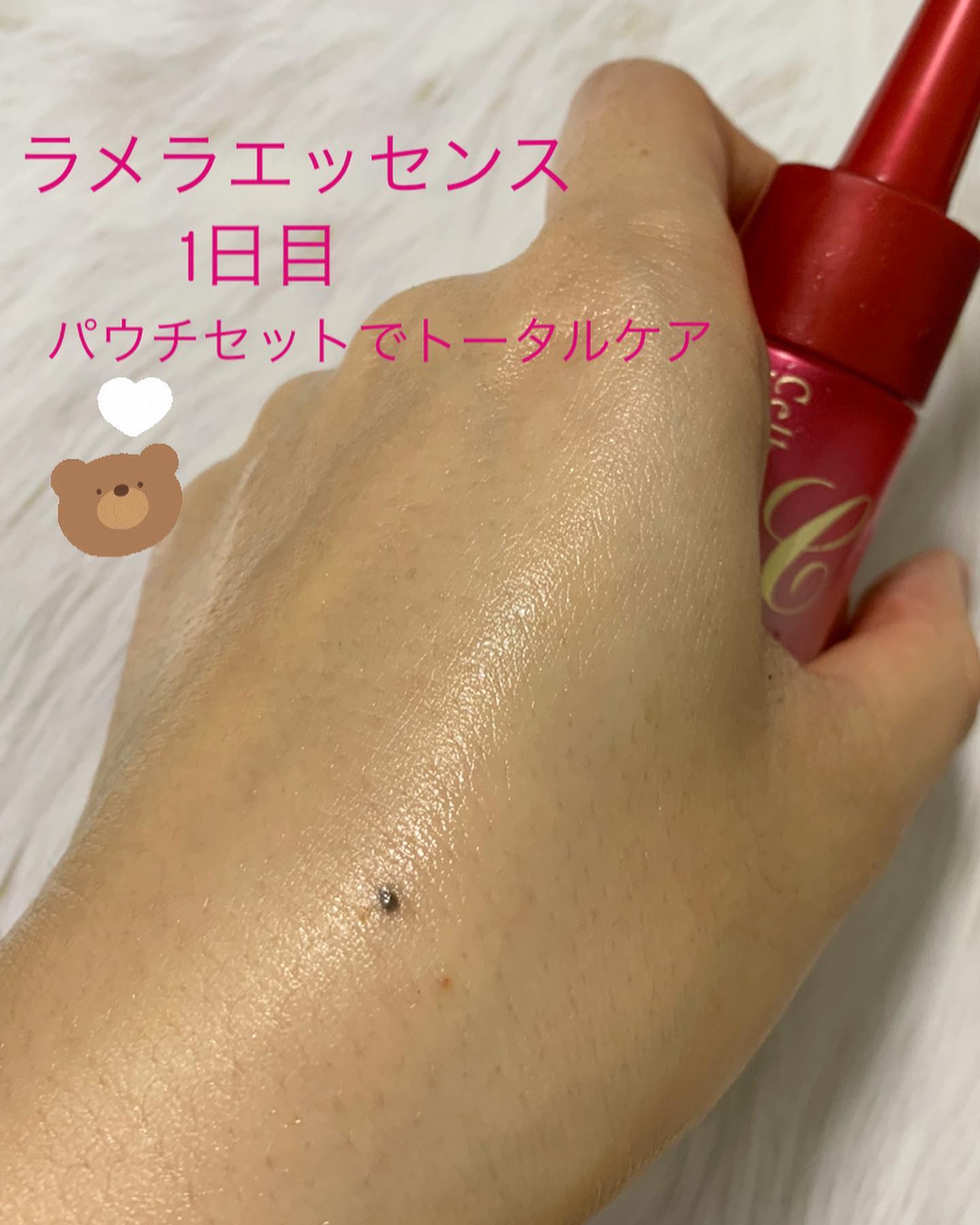 口コミ投稿：セルベスト化粧品さん(@celbest )のラメラエッセンスＣの長期モニターをさせてもらい…