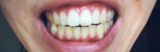 「歯」の画像（1枚目）