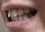 「白い歯になりたい！」の画像（1枚目）