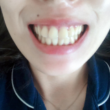 現在の歯