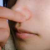 小鼻と頬の毛穴