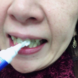 「薬用ホワイトニング デンタブラッシュ EX で白い歯へ♪」の画像（2枚目）
