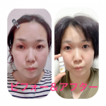 冬の乾燥ダメージで老け顔まっしぐら😱目の下の小じわにほうれい線…☠️疲れ顔を変えてくれた救世主！？艶髪艶肌研究所さんの【ラ・メラ(美容オイル)】お肌が乾燥する原因の一つ…のInstagram画像