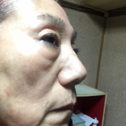 67歳です