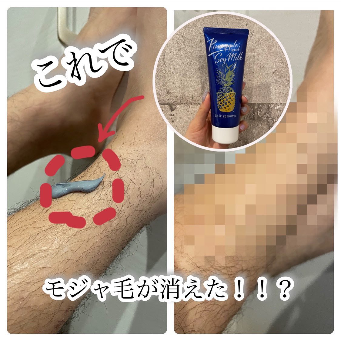 口コミ投稿：﻿彼氏が最近、美意識が高くなってきて﻿すね毛を始めとするムダ毛を﻿キレイにしたい模…