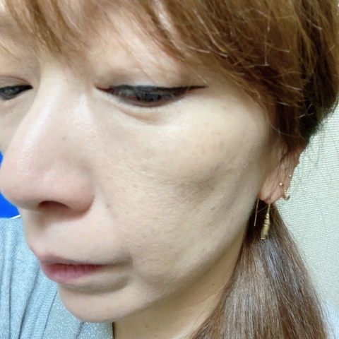 口コミ：＠コスメで第一位を獲得したクレンジングの画像（7枚目）