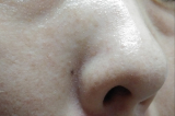 「小鼻のとこもきれい」の画像（3枚目）
