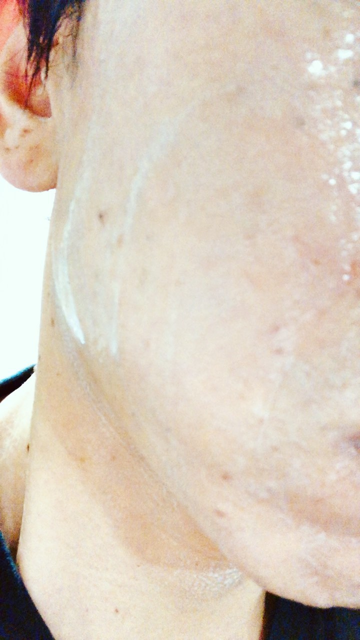 口コミ投稿：2週間経過肌荒れが治り始めた。😏#セルベスト #ピュアクレイ洗顔パック #ラメラエステ…