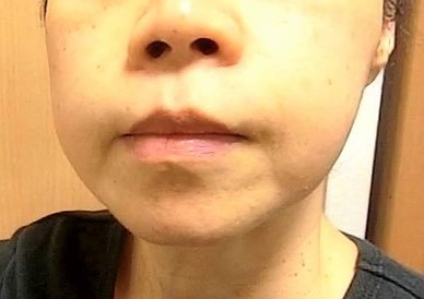 口コミ：シュワトレーゼ　薬用リンクルホワイトゲル　洗顔後はこれ一つ。あらゆる肌悩みをオールケア！の画像（14枚目）