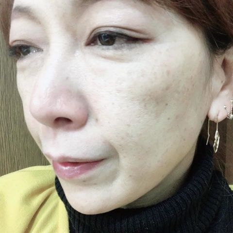 口コミ：冬は美白の季節ですね(*＾艸＾*)の画像（7枚目）