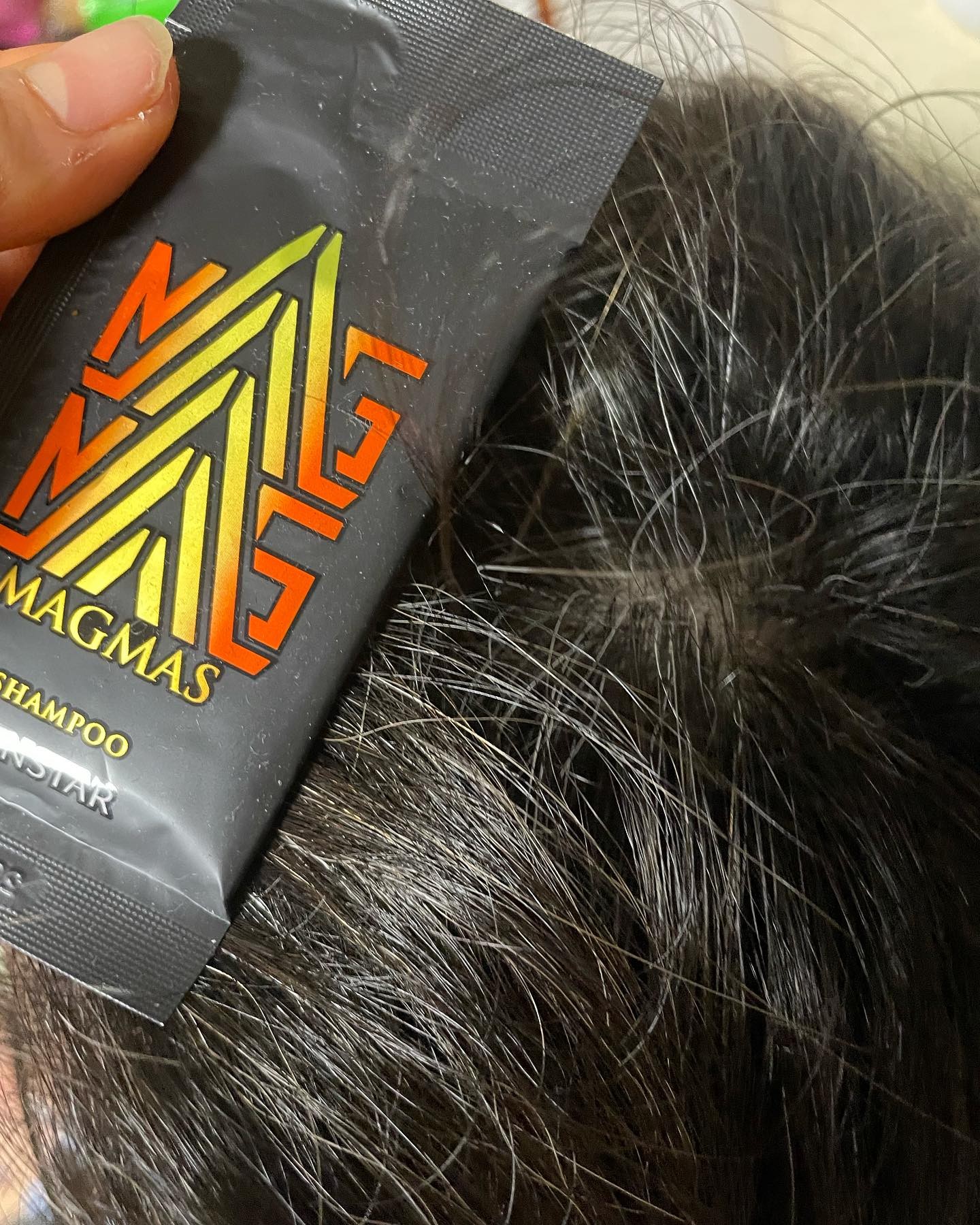 口コミ投稿：MAGMAS亜鉛導入亜鉛の力で髪を強くする、薄毛や頭皮に悩みの男性にお勧めです。加齢…